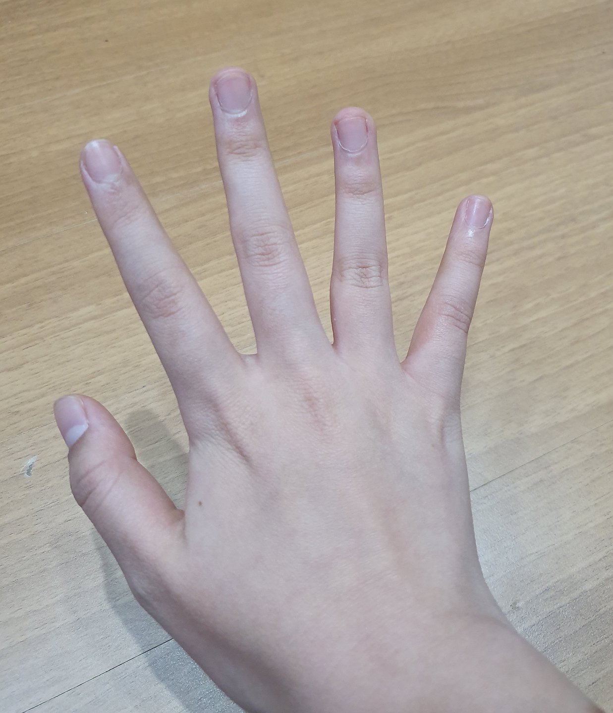 thumb