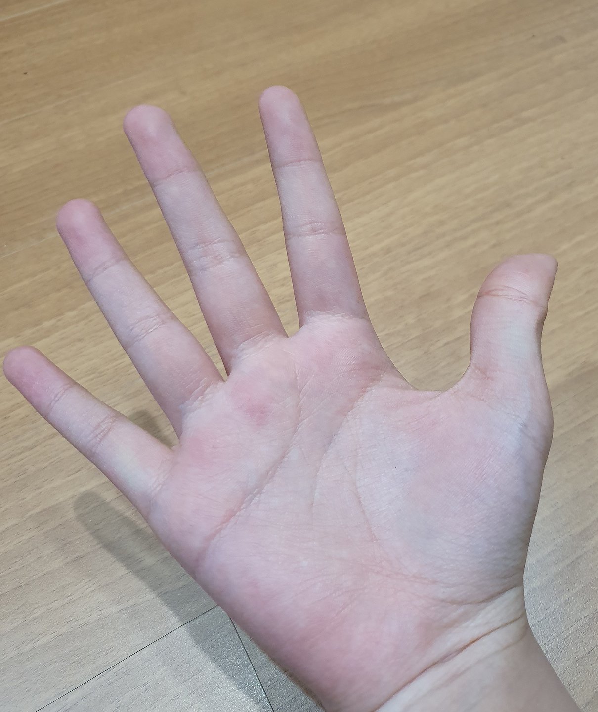 thumb